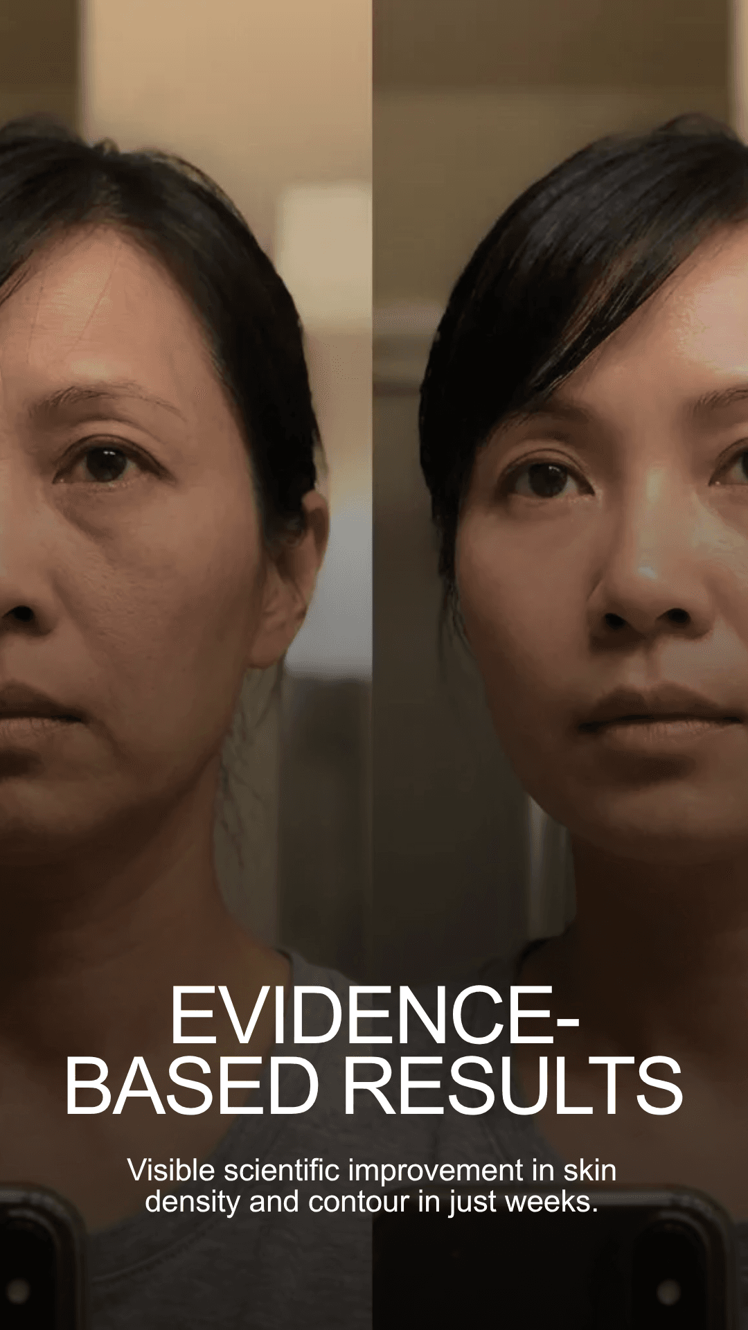 Evidence-Based Results — Visible scientific improvement in skin density and contour in just weeks